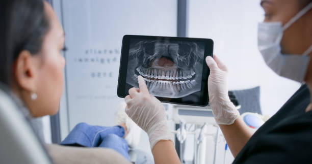 Licensed Tooth Extraction service in Alpharetta, GA - Smile Center Dentistry